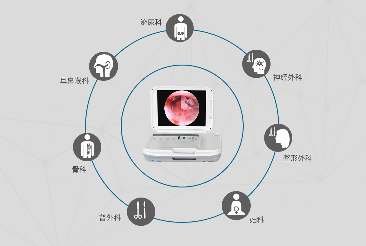 內(nèi)窺鏡攝像機(jī)的應(yīng)用領(lǐng)域有哪些？