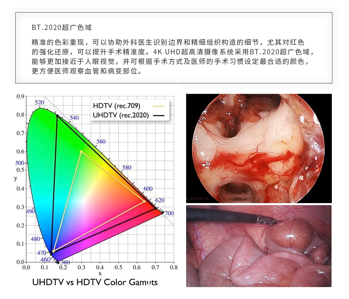 【4K醫(yī)用內(nèi)窺鏡攝像系統(tǒng)】您的第一臺(tái)“4K”找到了嗎？