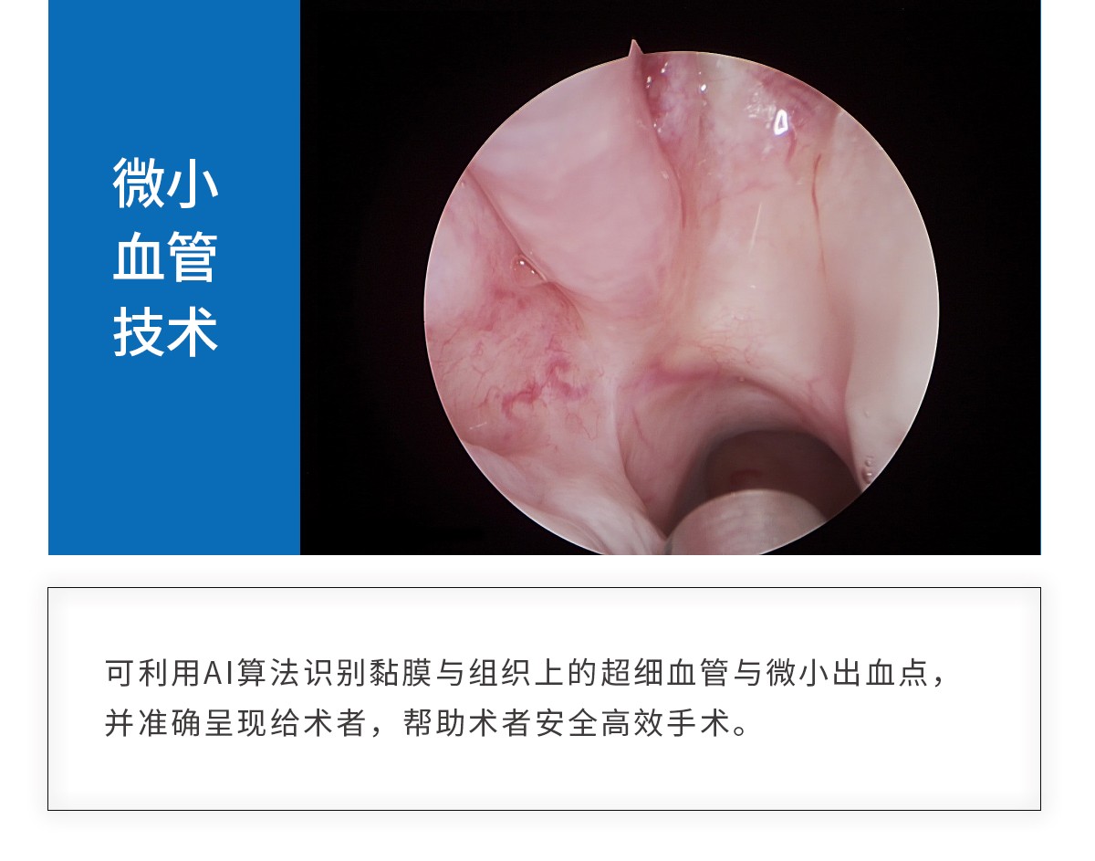 【4K醫(yī)用內(nèi)窺鏡攝像系統(tǒng)】您的第一臺(tái)“4K”找到了嗎？